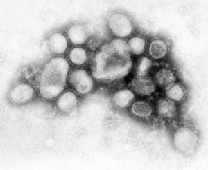 090504-swine-flu-picture_big Photo: CDC Influenza Laboratory
